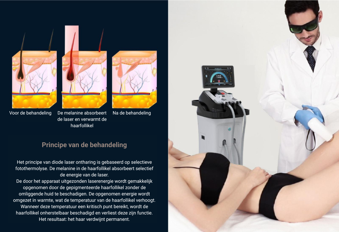 Professionele Diode Laser Ontharingsapparatuur voor salons en klinieken MDR Solution